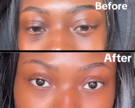 Peptide Collagen Hydrogel Eye Patch