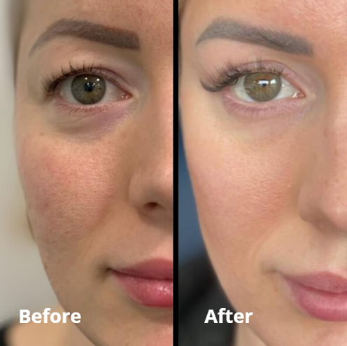 Peptide Collagen Hydrogel Eye Patch