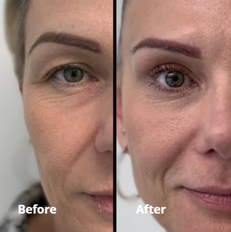 Peptide Collagen Hydrogel Eye Patch