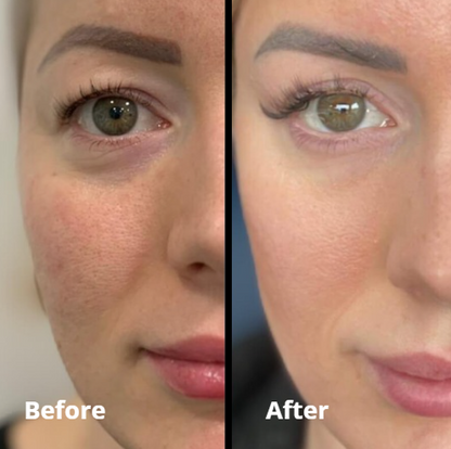 Peptide Collagen Hydrogel Eye Patch